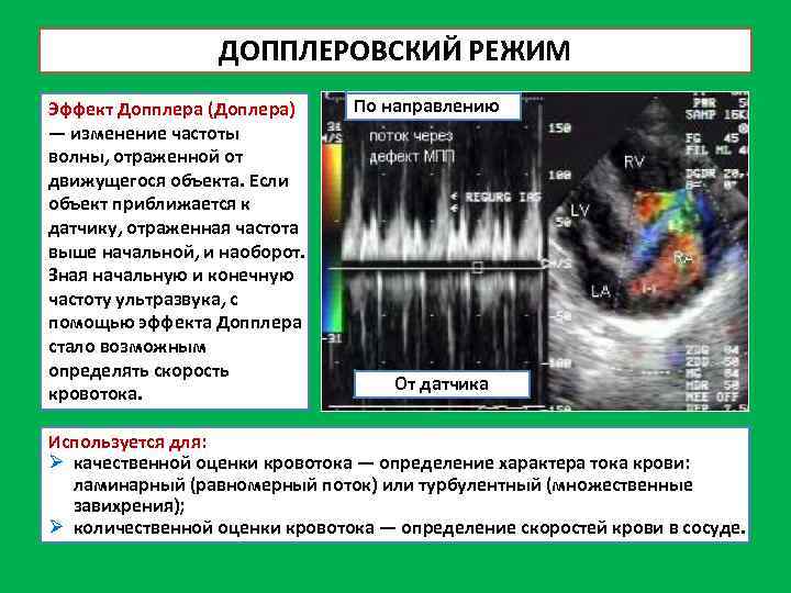 ДОППЛЕРОВСКИЙ РЕЖИМ Эффект Допплера (Доплера) — изменение частоты волны, отраженной от движущегося объекта. Если