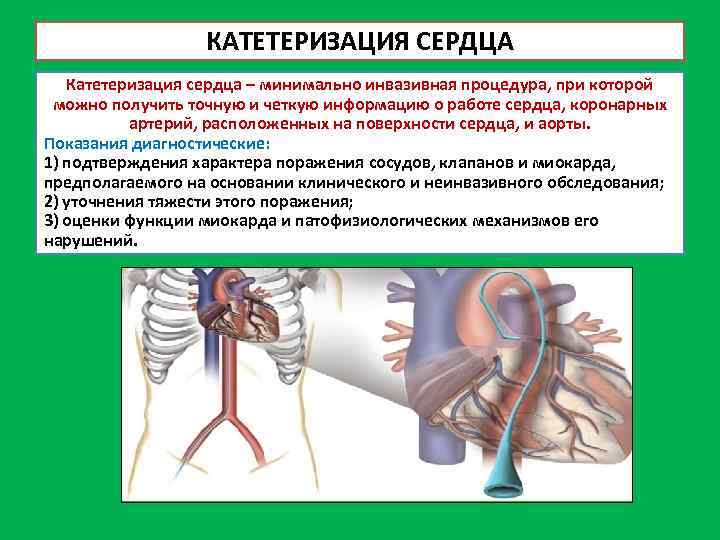 КАТЕТЕРИЗАЦИЯ СЕРДЦА Катетеризация сердца – минимально инвазивная процедура, при которой можно получить точную и