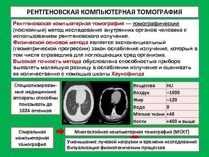 РЕНТГЕНОВСКАЯ КОМПЬЮТЕРНАЯ ТОМОГРАФИЯ Рентгеновская компьютерная томография — томографический (послойный) метод исследования внутренних органов человека