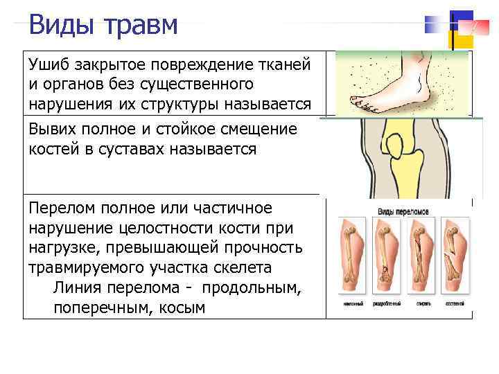 Виды травм Ушиб закрытое повреждение тканей и органов без существенного нарушения их структуры называется