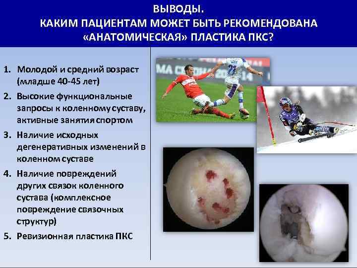 ВЫВОДЫ. КАКИМ ПАЦИЕНТАМ МОЖЕТ БЫТЬ РЕКОМЕНДОВАНА «АНАТОМИЧЕСКАЯ» ПЛАСТИКА ПКС? 1. Молодой и средний возраст