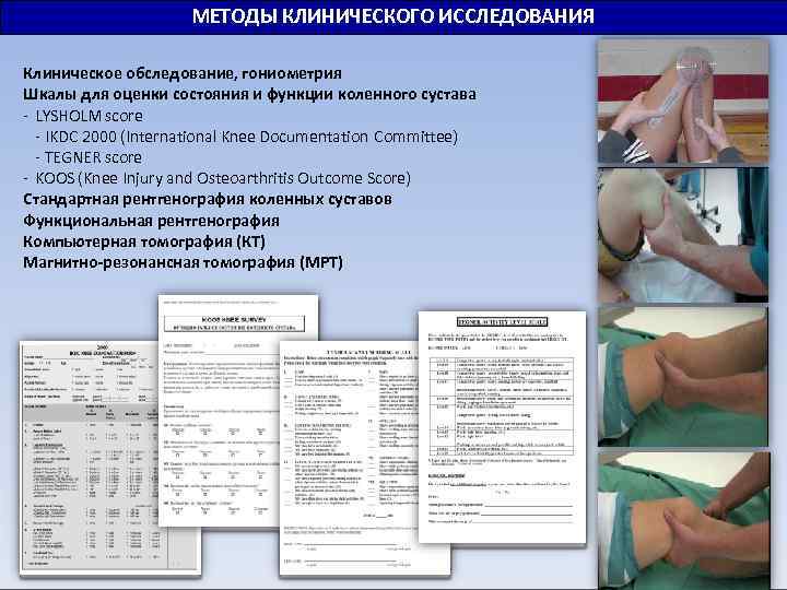 МЕТОДЫ КЛИНИЧЕСКОГО ИССЛЕДОВАНИЯ Клиническое обследование, гониометрия Шкалы для оценки состояния и функции коленного сустава