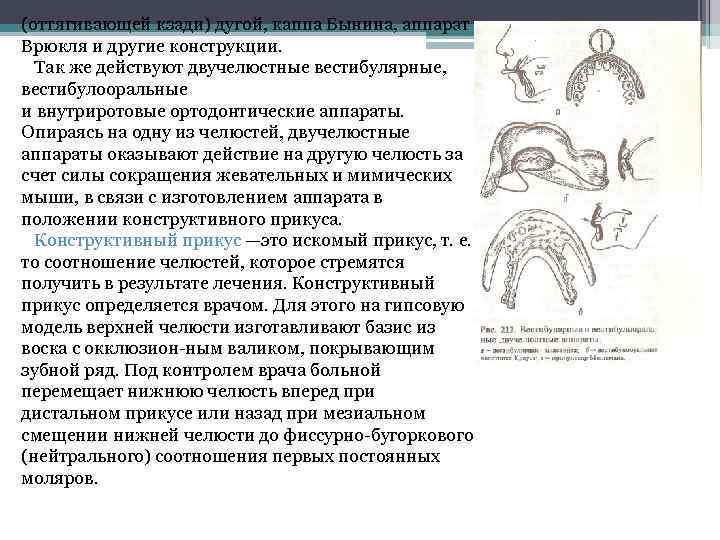 (оттягивающей кзади) дугой, каппа Бынина, аппарат Врюкля и другие конструкции. Так же действуют двучелюстные