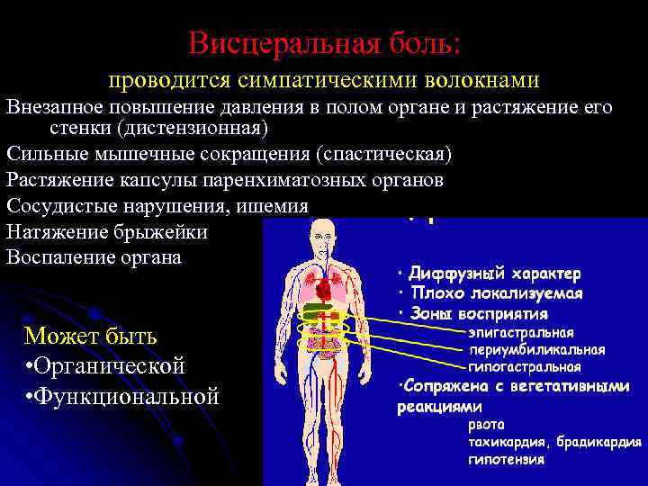 Висцеральная боль: проводится симпатическими волокнами Внезапное повышение давления в полом органе и растяжение его