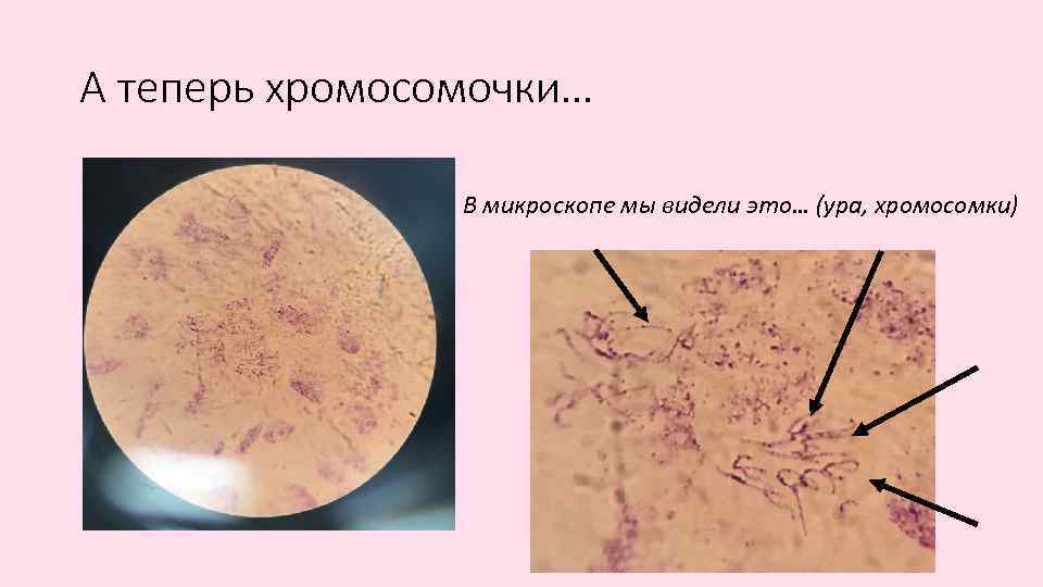 А теперь хромосомочки… В микроскопе мы видели это… (ура, хромосомки) 