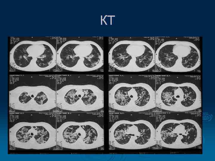 КТ 