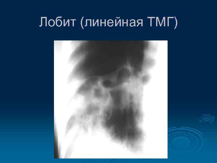 Лобит (линейная ТМГ) 