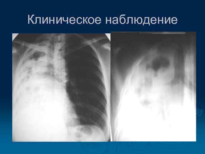 Клиническое наблюдение 