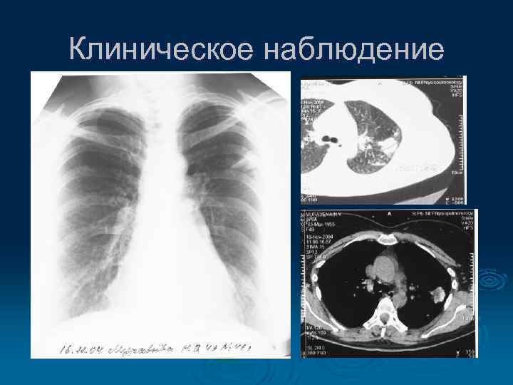 Клиническое наблюдение 