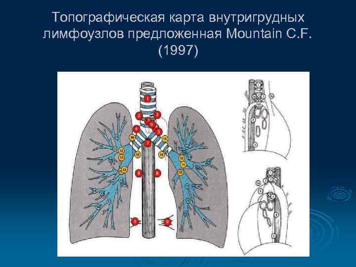 Топографическая карта внутригрудных лимфоузлов предложенная Mountain С. F. (1997) 