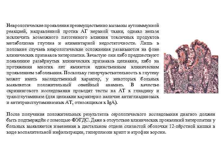 Неврологические проявления преимущественно вызваны аутоиммунной реакцией, направленной против АГ нервной ткани, однако нельзя исключить