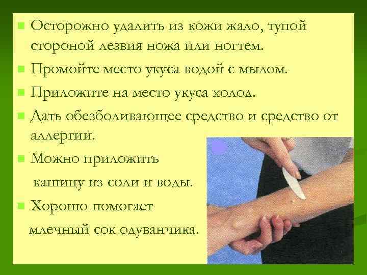 Осторожно удалить из кожи жало, тупой стороной лезвия ножа или ногтем. n Промойте место