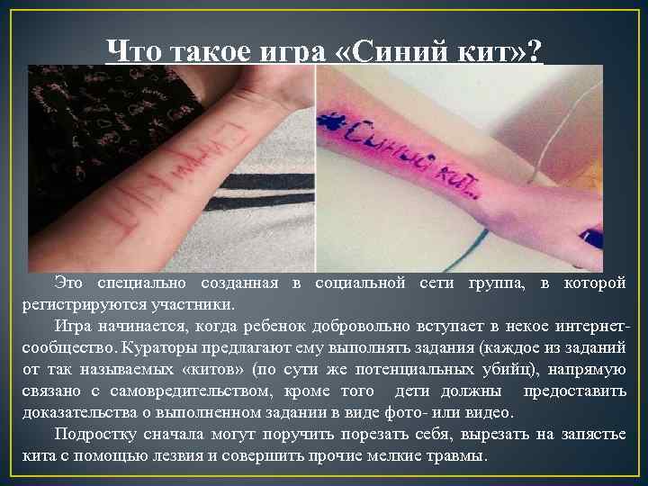 Что такое игра «Синий кит» ? Это специально созданная в социальной сети группа, в