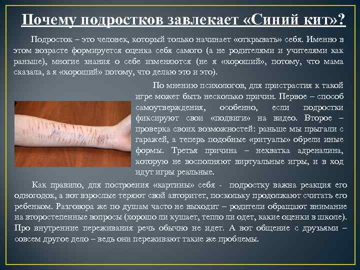 Почему подростков завлекает «Синий кит» ? Подросток – это человек, который только начинает «открывать»