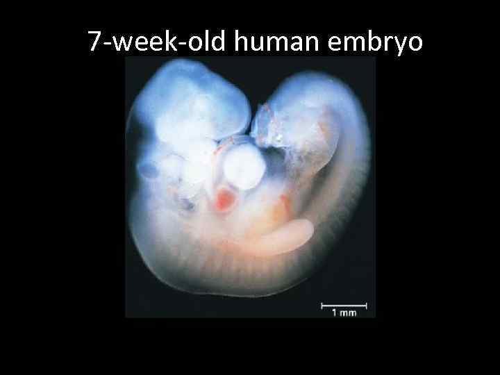 7 -week-old human embryo 