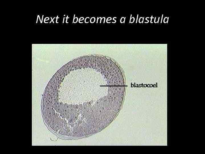 Next it becomes a blastula 