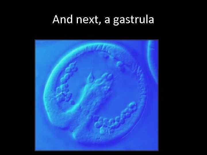 And next, a gastrula 