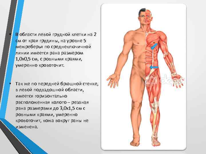  • В области левой грудной клетки на 2 см от края грудины, на
