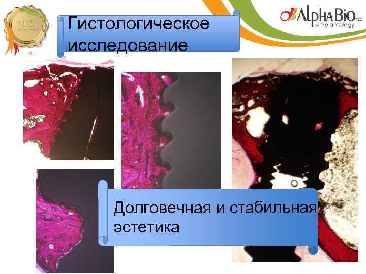 Гистологическое исследование Долговечная и стабильная эстетика 
