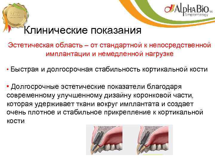 Клинические показания Эстетическая область – от стандартной к непосредственной имплантации и немедленной нагрузке •