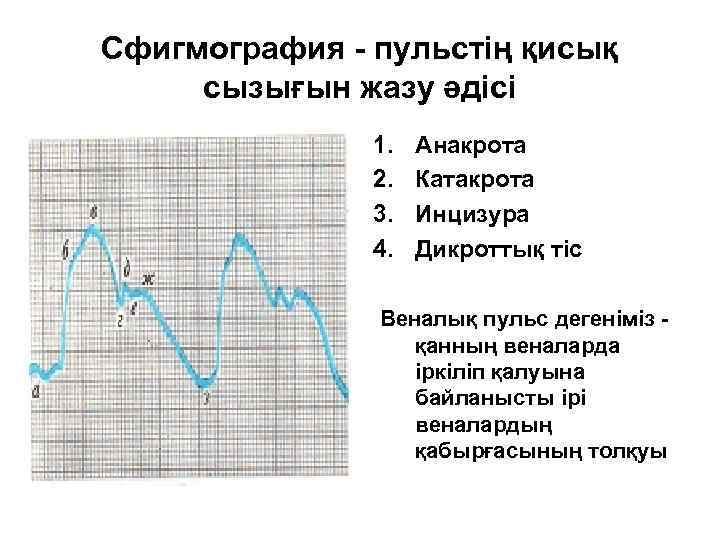 Сфигмография - пульстің қисық сызығын жазу әдісі 1. 2. 3. 4. Анакрота Катакрота Инцизура