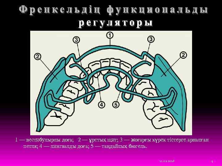 1 — вестибулырлы доға; 2 — ұрттық щит; 3 — жоғарғы күрек тістерге арналған