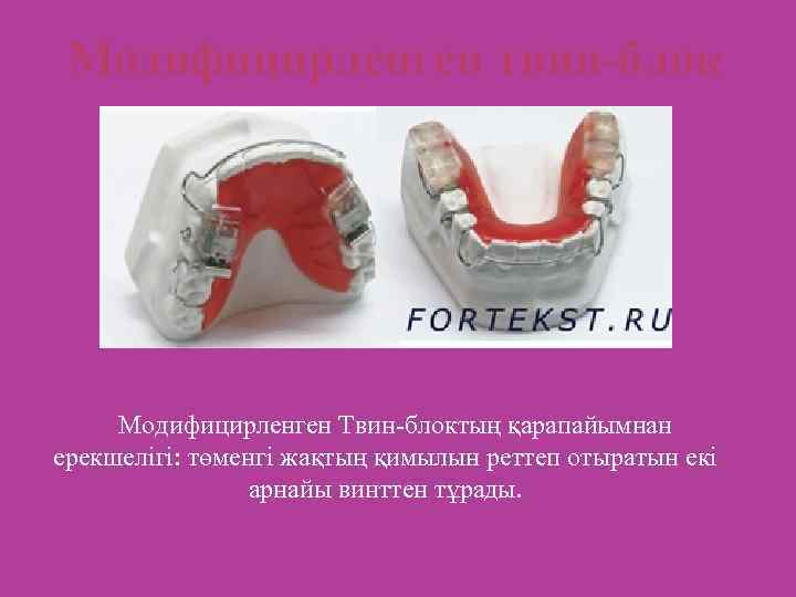 Модифицирленген твин-блок Модифицирленген Твин-блоктың қарапайымнан ерекшелігі: төменгі жақтың қимылын реттеп отыратын екі арнайы винттен