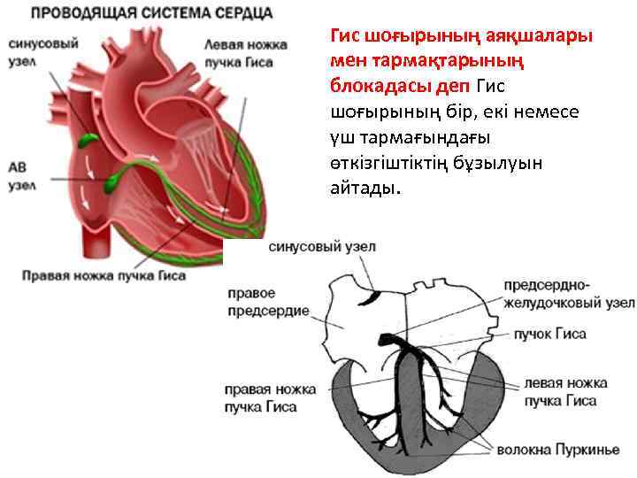 Правая ножка гиса. Пучок Гиса в сердце.