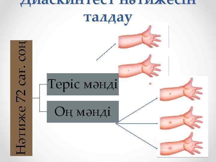 Какая норма диаскинтеста. Положительная реакция на диаскинтест. Проба диаскинтест интерпретация. Реакция диаскинтест норма. Диаскинтест отрицательный.