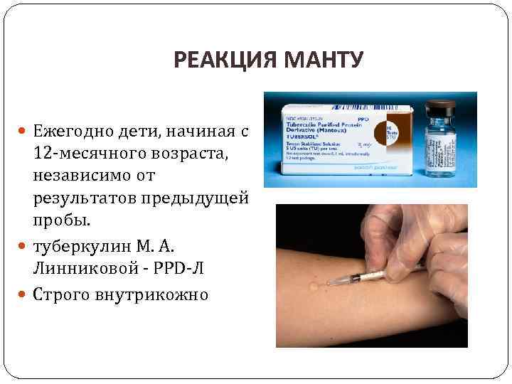 РЕАКЦИЯ МАНТУ Ежегодно дети, начиная с 12 -месячного возраста, независимо от результатов предыдущей пробы.
