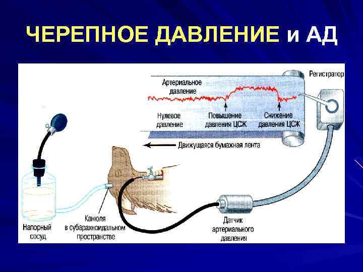 ЧЕРЕПНОЕ ДАВЛЕНИЕ и АД 