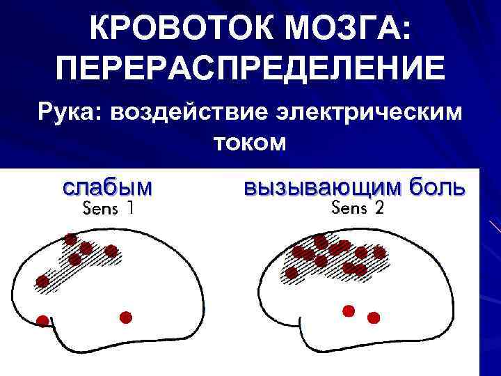 КРОВОТОК МОЗГА: ПЕРЕРАСПРЕДЕЛЕНИЕ Рука: воздействие электрическим током слабым вызывающим боль 