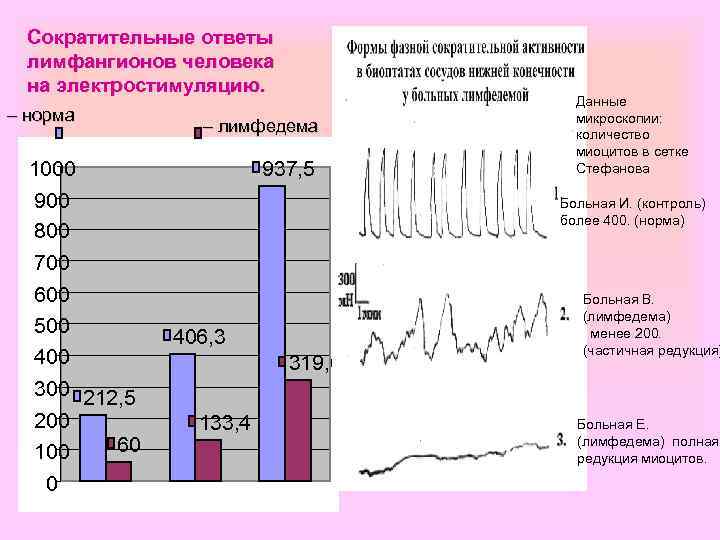 Сократительные ответы лимфангионов человека на электростимуляцию. – норма – лимфедема 1000 937, 5 900