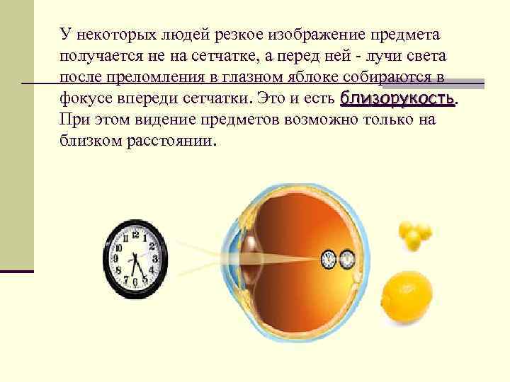 У некоторых людей резкое изображение предмета получается не на сетчатке, а перед ней -