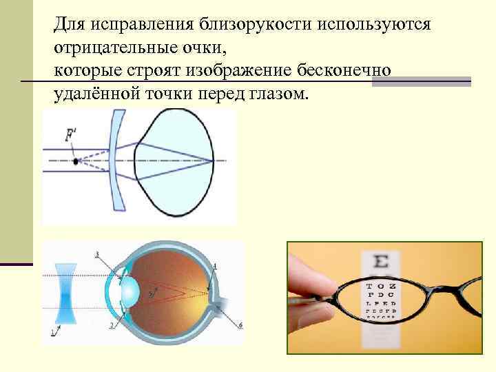 Презентация дефекты зрения очки