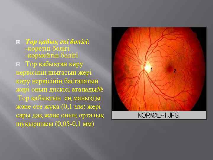 Тор қабық екі бөлігі: -көретін бөлігі -көрмейтін бөлігі Тор қабықтан көру нервісінің шығатын жері