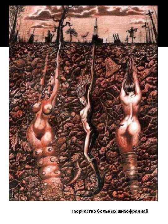 Творчество больных шизофренией 