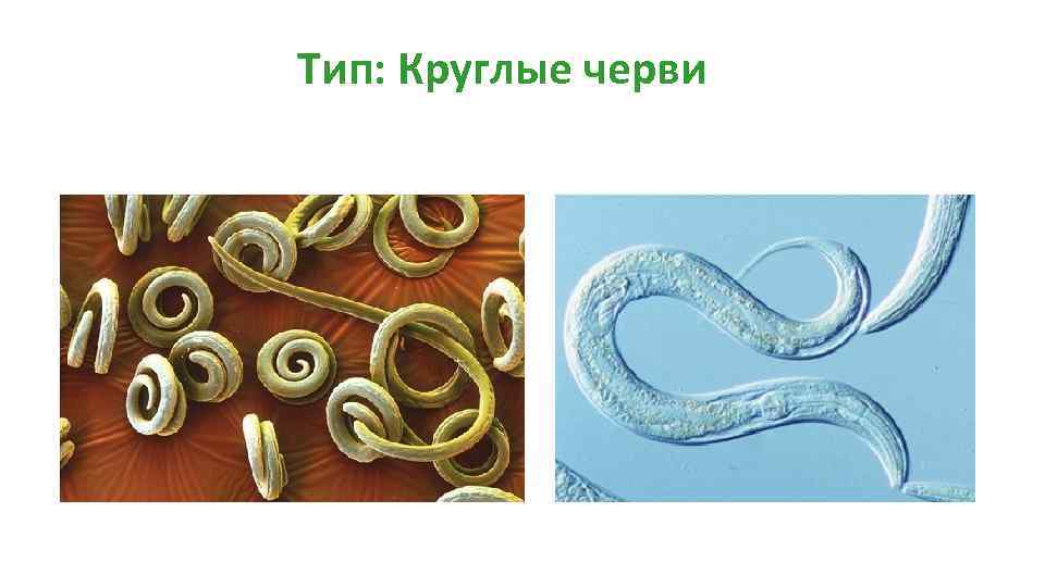 Выбери признаки круглых червей. Многообразие круглых червей. 1. Тип круглые черви.. Примеры беспозвоночных круглых червей.