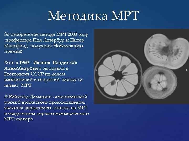 Методика МРТ За изобретение метода МРТ 2003 году профессора Пол Лотербур и Питер Мэнсфилд