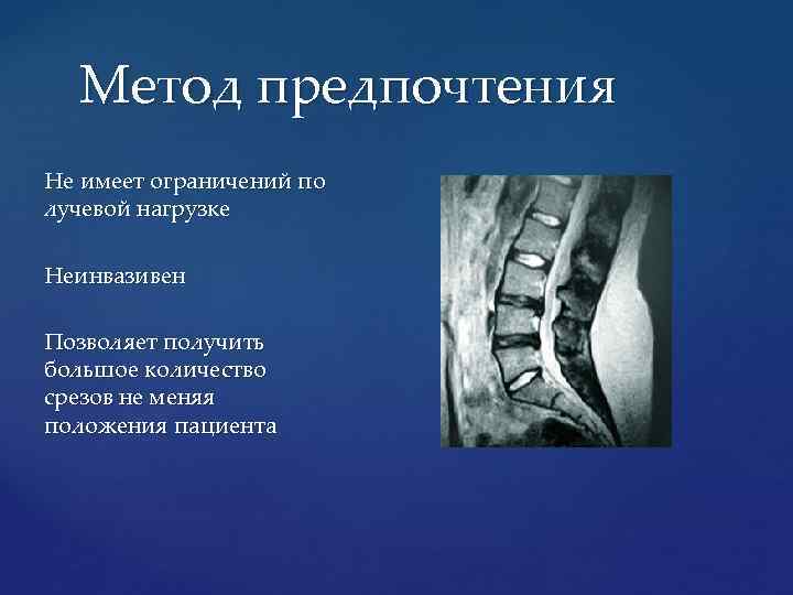 Метод предпочтения Не имеет ограничений по лучевой нагрузке Неинвазивен Позволяет получить большое количество срезов