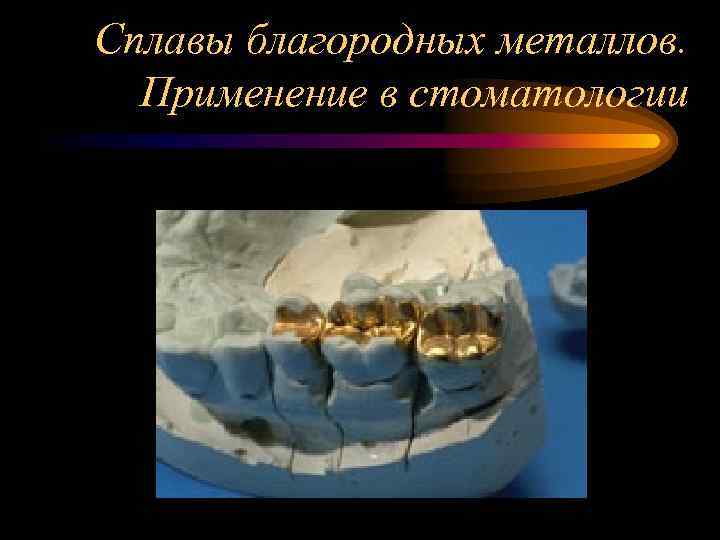 Сплавы благородных металлов. Применение в стоматологии 