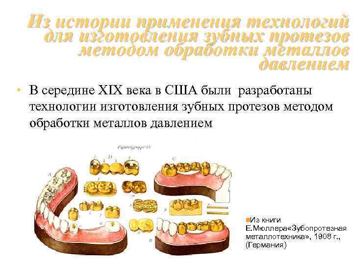 Из истории применения технологий для изготовления зубных протезов методом обработки металлов давлением • В