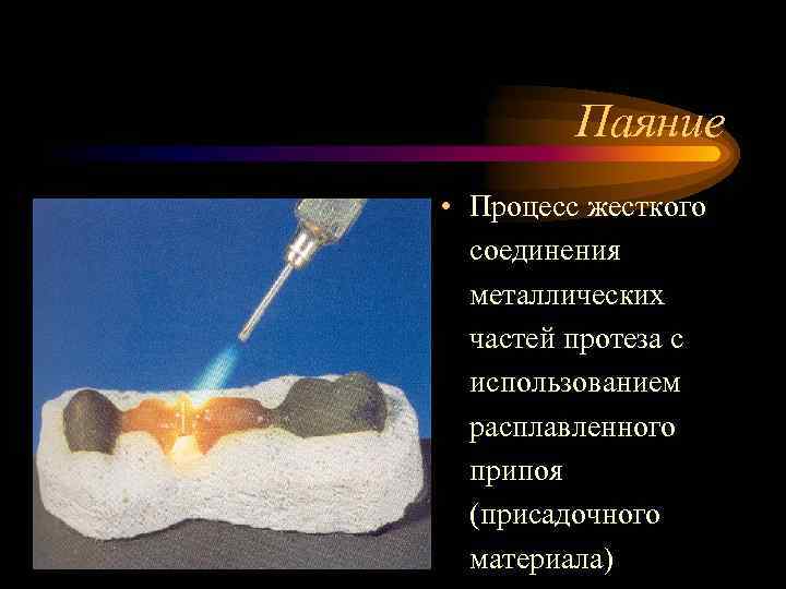 Паяние • Процесс жесткого соединения металлических частей протеза с использованием расплавленного припоя (присадочного материала)