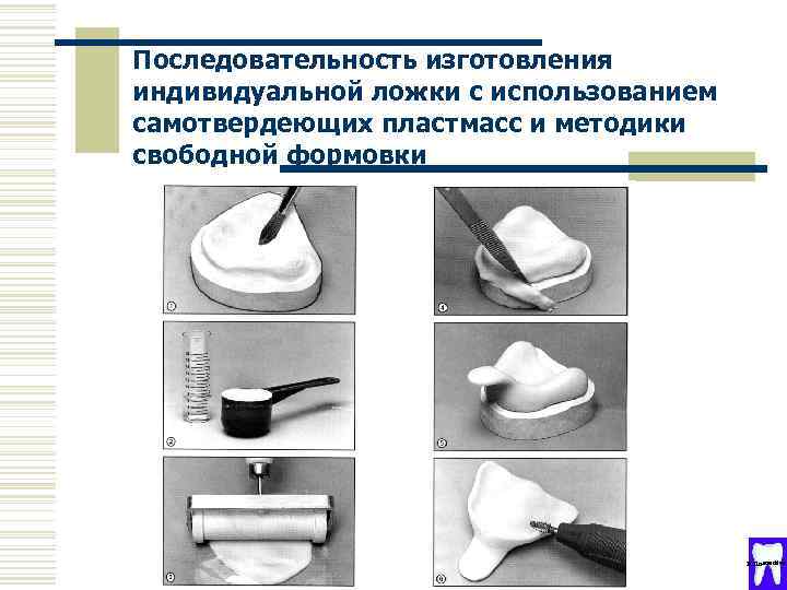 Индивидуальные ложки в ортопедической стоматологии презентация