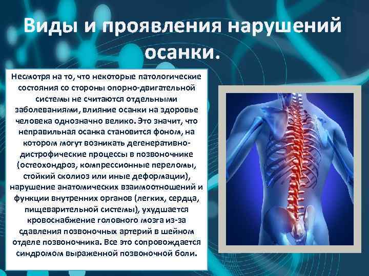 Виды и проявления нарушений осанки. Несмотря на то, что некоторые патологические состояния со стороны