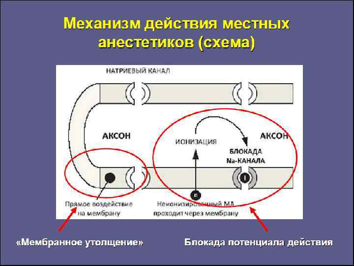 Действуют местно. Местные анестетики механизм действия. Механизм действия местного анестетика. Механизм местных анестетиков. Механизм действия местноанестезирующих средств.