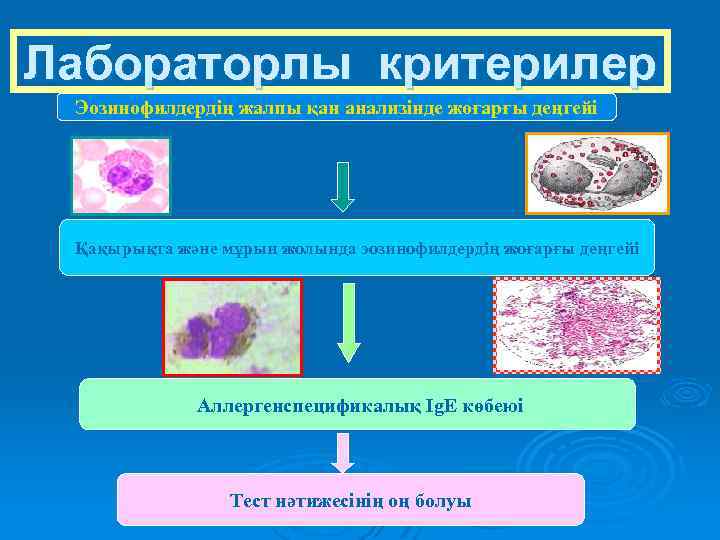 Лабораторлы критерилер Эозинофилдердің жалпы қан анализінде жоғарғы деңгейі Қақырықта және мұрын жолында эозинофилдердің жоғарғы