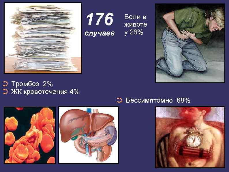 176 случаев Боли в животе у 28% ➲ Тромбоз 2% ➲ ЖК кровотечения 4%