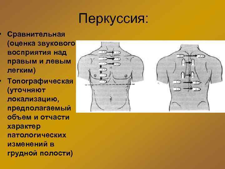  • Сравнительная (оценка звукового восприятия над правым и левым легким) • Топографическая (уточняют