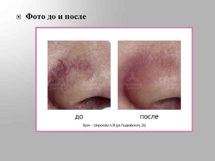  Фото до и после 